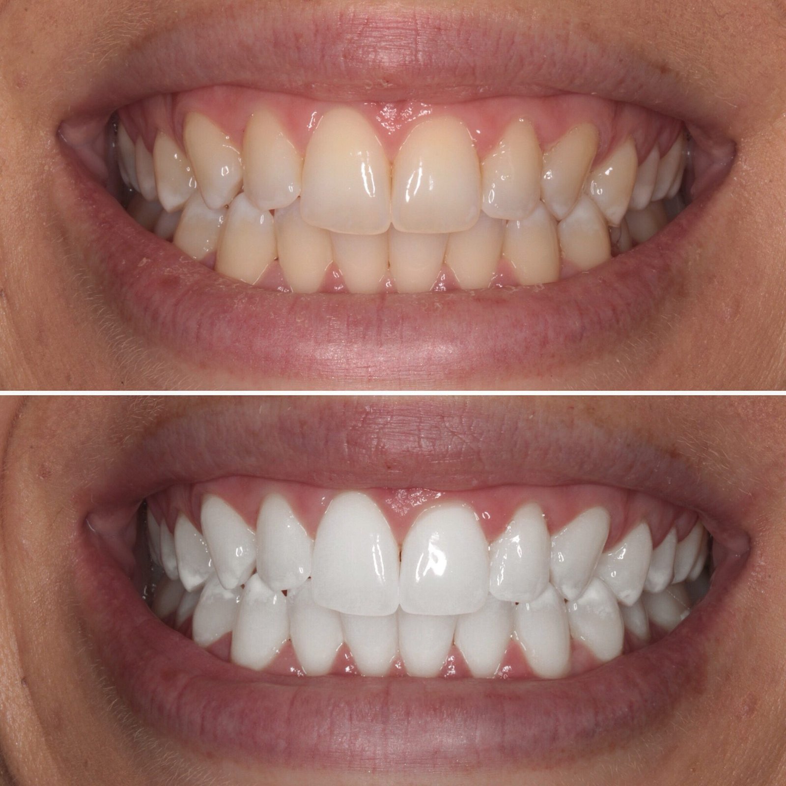 best dental clinic in Surat