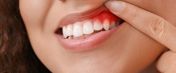 dental treatment in Gujarat