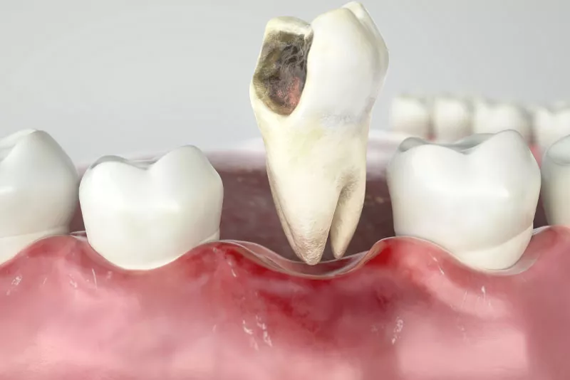 best dental clinic in Surat