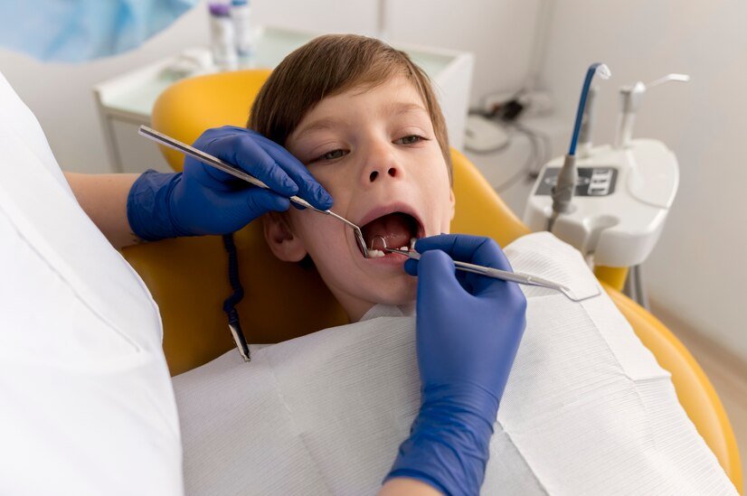 Best veneers teeth in Surat