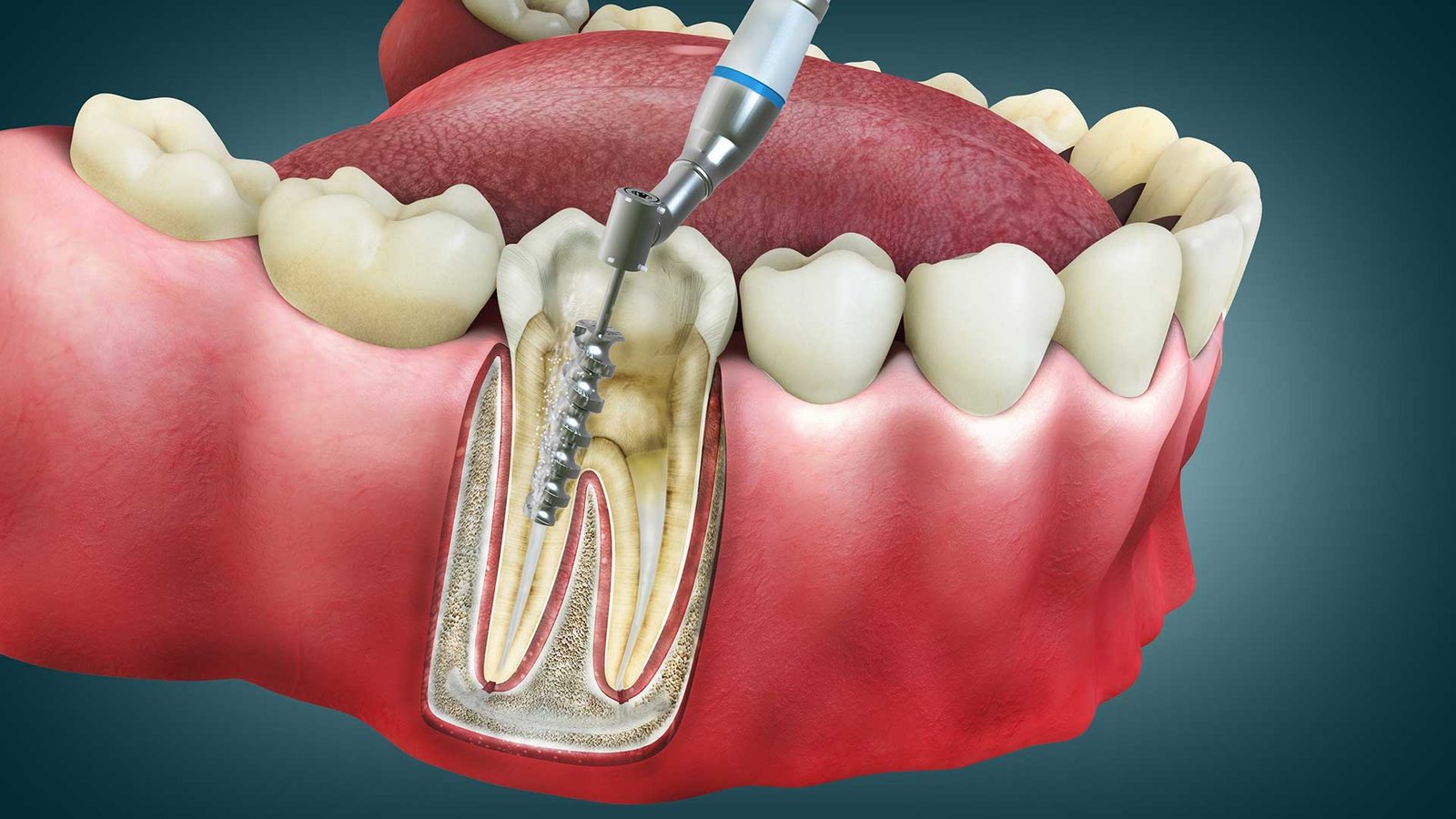 best dental clinic in Surat